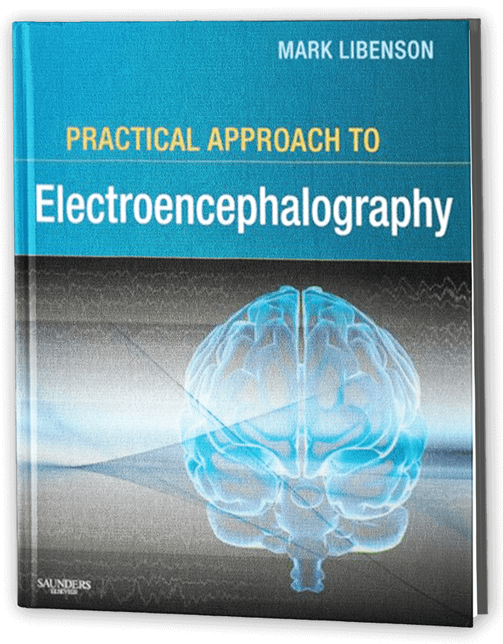 Practical approach to electroencephalography​